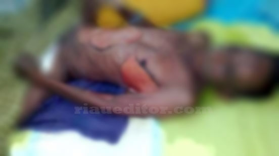 Pasien Operasi Katarak Gratis Meninggal Dunia Dalam Kondisi Mengenaskan