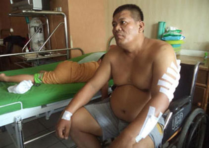 Aktivis Korban Pembacokan Beberkan Kronologis Penganiayaan yang Menimpanya