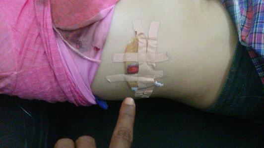 Pria di Bangko Pusako Rohil Tusuk Istri dengan Keris
