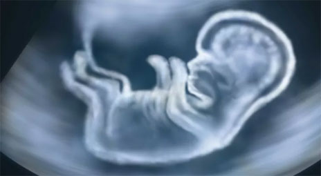 Manusia Diciptakan dari Alaq Dijelaskan dalam Alquran dan Sains
