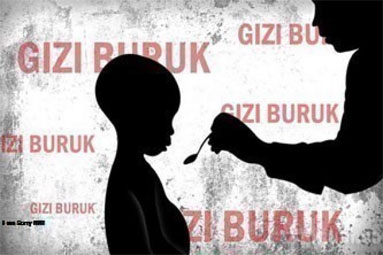 HUT Riau Ke-60, Dewan Sesali Penderita Gizi Buruk di Pekanbaru