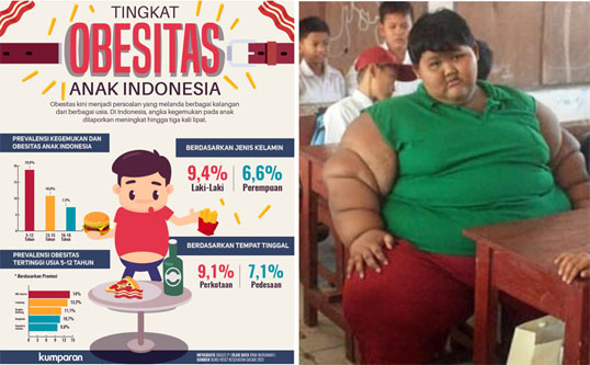 Melawan Obesitas pada Anak