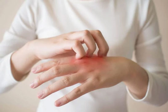 5 Cara Mengatasi Gatal Akibat Diabetes