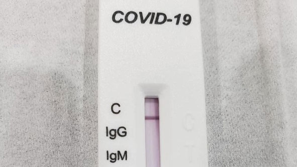 Tak Lama Lagi, RI Bakal Gencar Gelar Rapid Test Corona