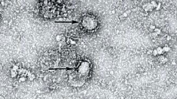 Studi Temukan Kelemahan Virus Corona
