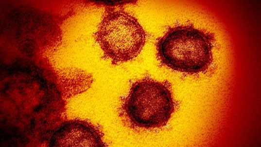 Bos Laboratorium Wuhan Sudah Prediksi Virus Covid-19?