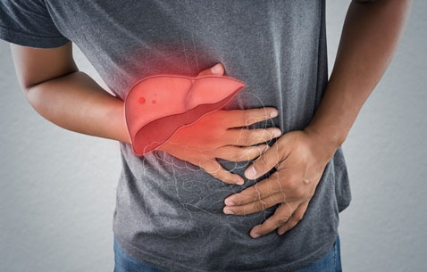 Mengenal Lebih Jauh Tentang Hepatitis Akut
