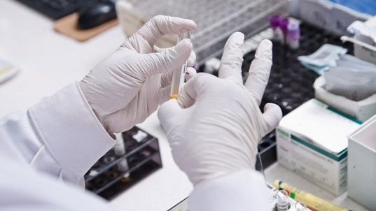 Di Malaysia PCR Swab Cuma Rp 900 Ribu, Di RI Selangit!