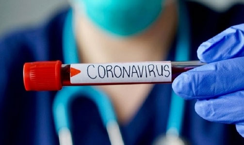 Update 25 Agustus: Positif Covid-19 Bertambah 2.447 Jadi 157.859 Orang