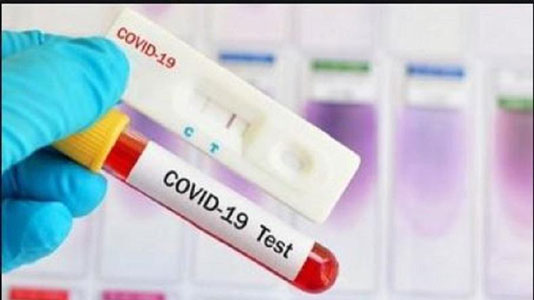 30 Agustus, Pasien Positif Covid-19 Tambah 2.858 Jadi 172.053 Orang