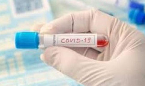 Update 28 September, Positif Covid-19 Bertambah 3.509 Jadi 278.722 Orang