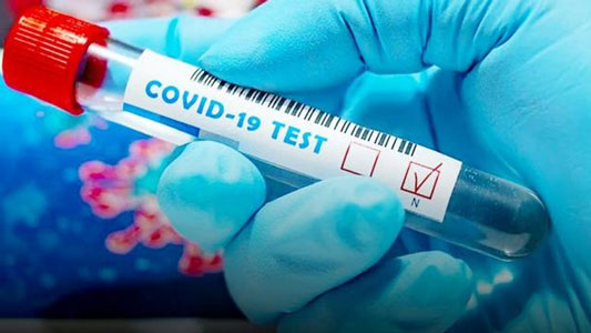 Lagi, 192 Kasus Terkonfirmasi di Riau, 61 Pasien Sembuh dan 3 Meninggal Dunia