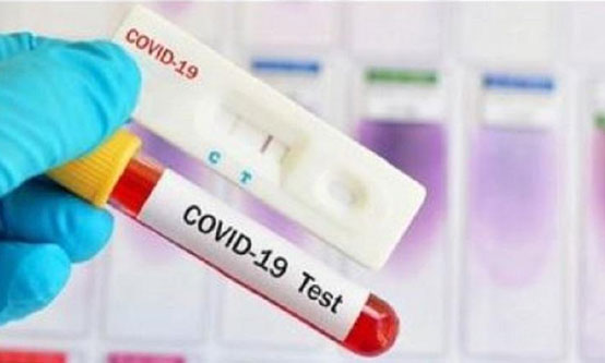 14 September, Pasien Positif Covid-19 Tambah 3.141 Jadi 221.523 Orang
