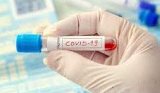 Positif Covid-19 Sehari 4.284 Orang, Ini 12 Provinsi dengan Penambahan Terbanyak