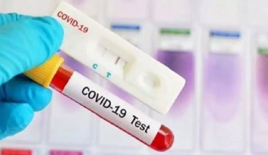 Tambah 3.992 Pasien, Kasus Positif Covid-19 Tembus 300.000 Orang
