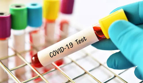 Update Senin 1 Maret 2021: Positif Covid-19 Bertambah 6.680, Sembuh 9.212, Meninggal 159 orang