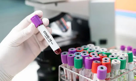 Update Jumat 9 April 2021: Bertambah 5.265, Positif Covid-19 Jadi 1.558.145 Orang, 1.405.659 Sembuh