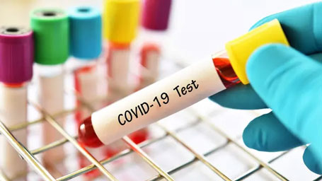 Update: 6.327 orang Dinyatakan Positif Covid-19 per 7 Mei 2021