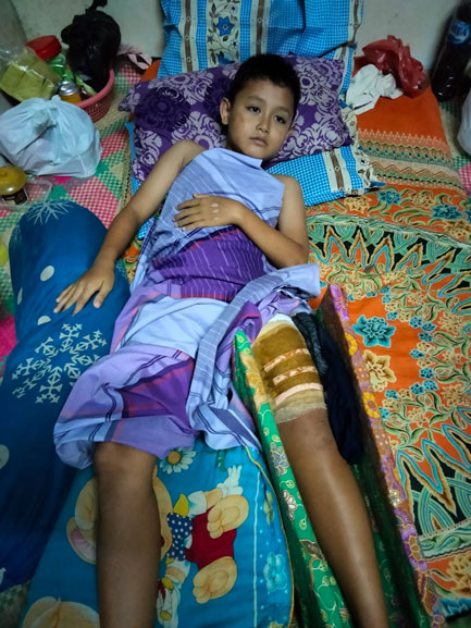 Sang Ayah Meninggal, Bocah 11 Tahun Korban Lakalantas Ini Butuh Uluran Tangan Dermawan