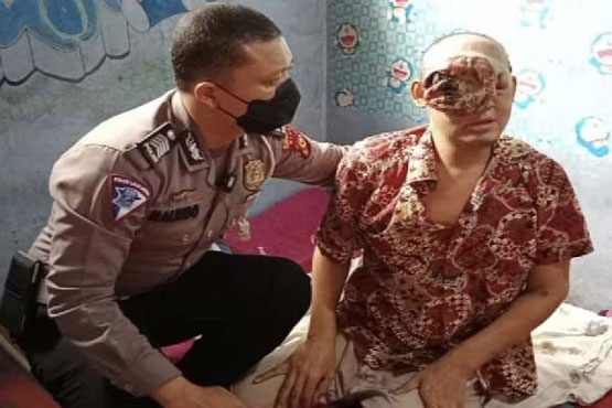 Prihatin Tumor Ganas Tutupi Wajah Arianto, Polisi Ini Carikan Pendonasi