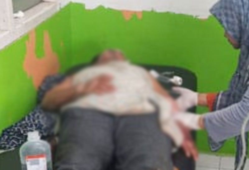 Suami di Inhu Bakar Istri dengan Pertalite