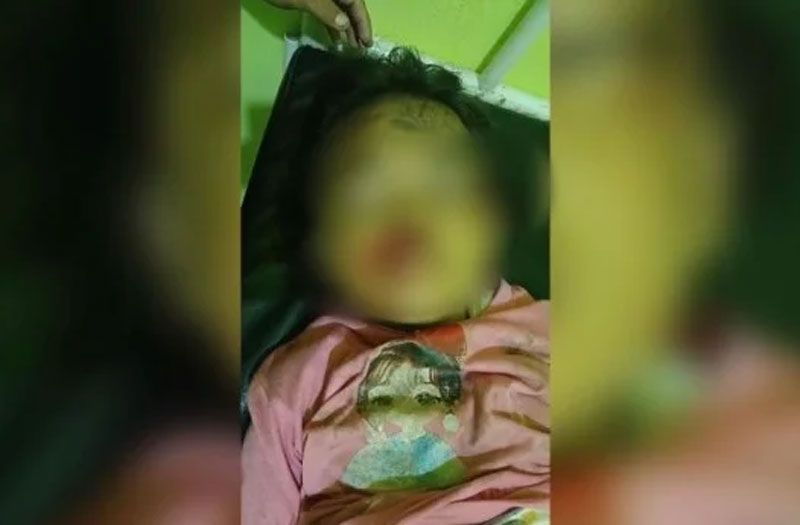 Kawanan Gajah Liar mengamuk di Rumbai, Anak 8 tahun Luka Serius
