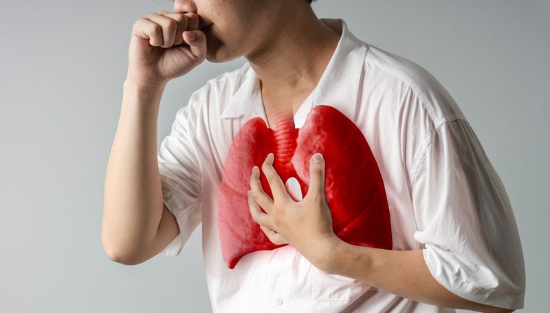 Indonesia Peringkat Kedua Kasus TBC Dunia, Perkuat Kolaborasi