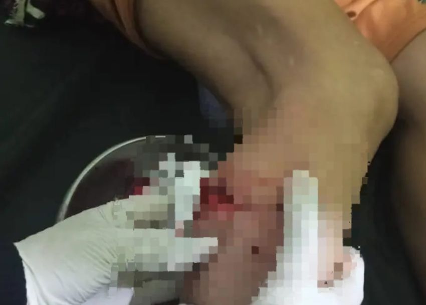 Teror Monyet Kian Meresahkan Warga Tembilahan  Inhil, Belasan Korban Dilarikan ke Rumah Sakit